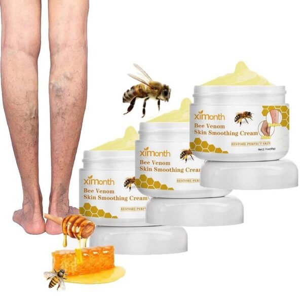 Varicose veins - Furzero Bienengift Krampfadern Crème